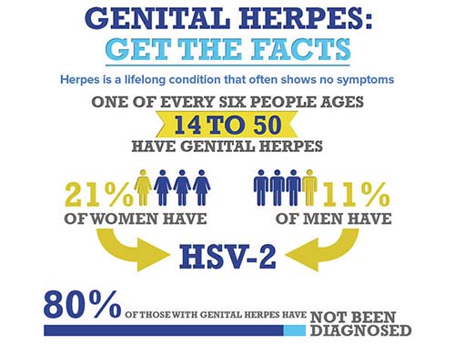80-90% of people with herpes are unaware they have herpes